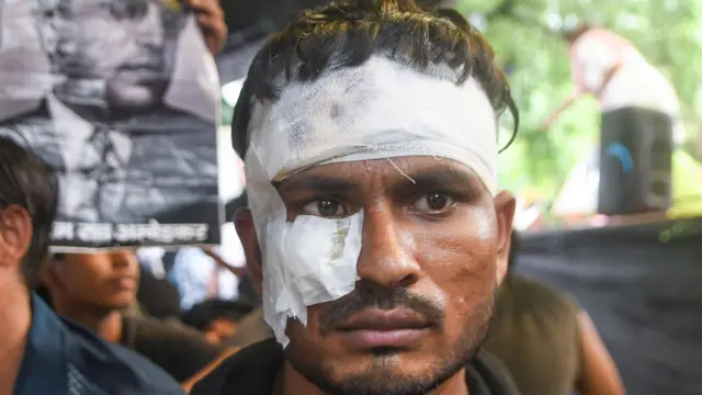 21 जुलै रोजी CJPच्या संसद मोर्चात अनेक आंदोलकांवर पोलिसांना लाठीमार केला 