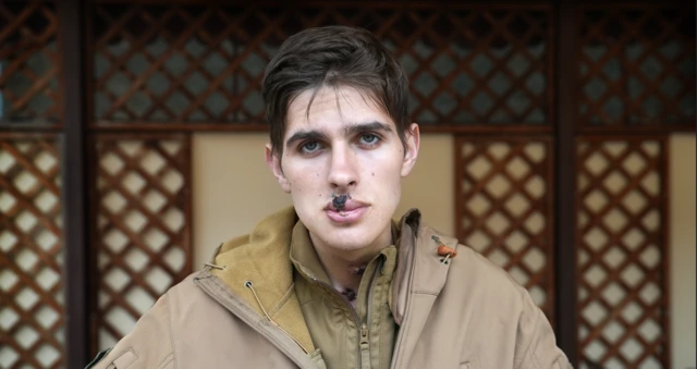 인중에 큰 상처를 입은 이반의 모습