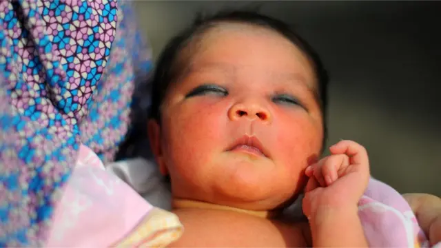 బిడ్డ శరీరంలో బిలిరుబిన్ ఉత్పత్తి ఎక్కువగా ఉండడం వల్ల బిడ్డ కంటి పొరలకూ, చర్మానికీ పట్టి కళ్ళు, శరీరం పసుపుపచ్చగా మారతాయి