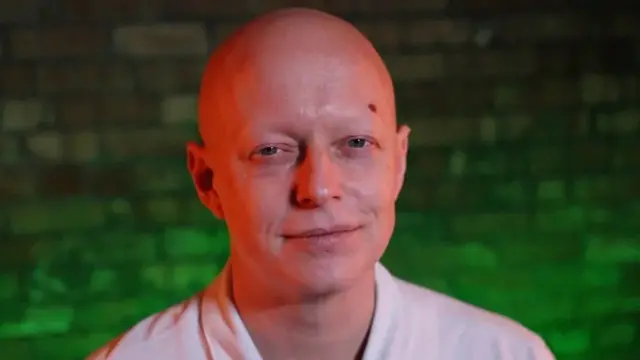 کچھ لوگ کم عمری میں ہی گنج پن کا شکار کیوں ہوجاتے ہیں؟