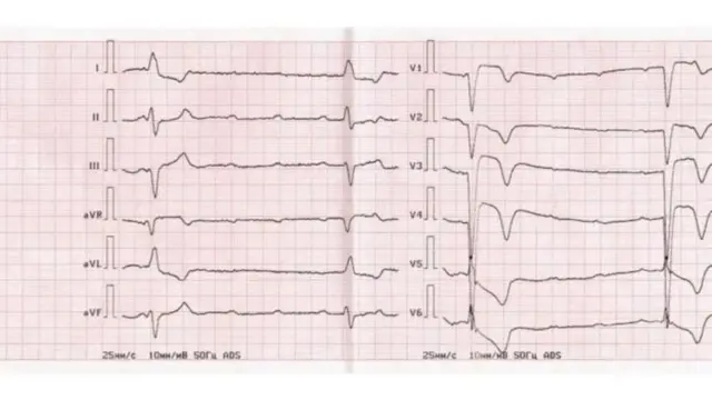 પ્રતીકાત્મક તસવીર