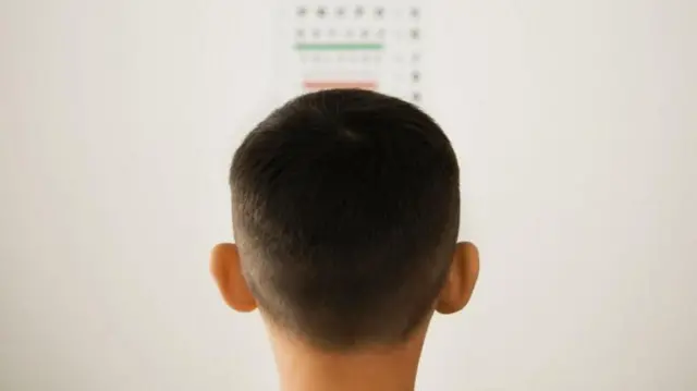 పిల్లల్లో మయోపియా