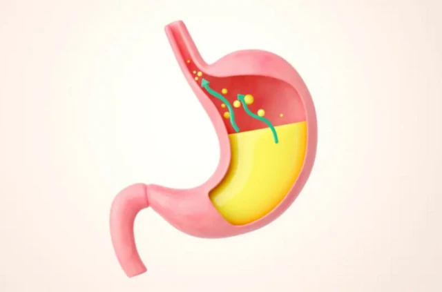 அமிலத்தன்மை - கெர்ட்