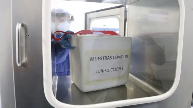 Pruebas de diagnóstico de covid 19.