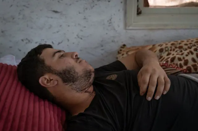 یعقوب نسان، ۱۷ ساله، در جریان حمله‌ گروه بزرگی از شهرک‌نشینان به دوما هدف شلیک گلوله‌ای قرار گرفت که به گردنش اصابت کرد