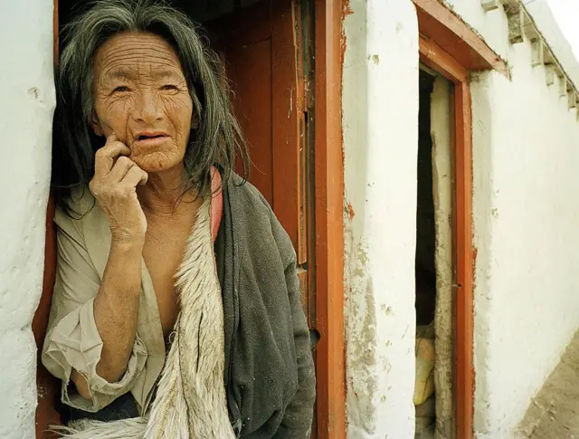 అల్జీమర్స్