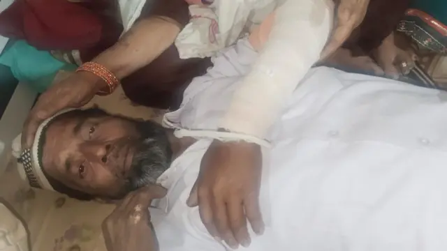 मेडिकल परीक्षण में मोहम्मद शाहिद के बाएं हाथ और पसलियों में चोट की पुष्टि हुई है