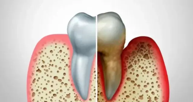 பல், அரோக்கியம்
