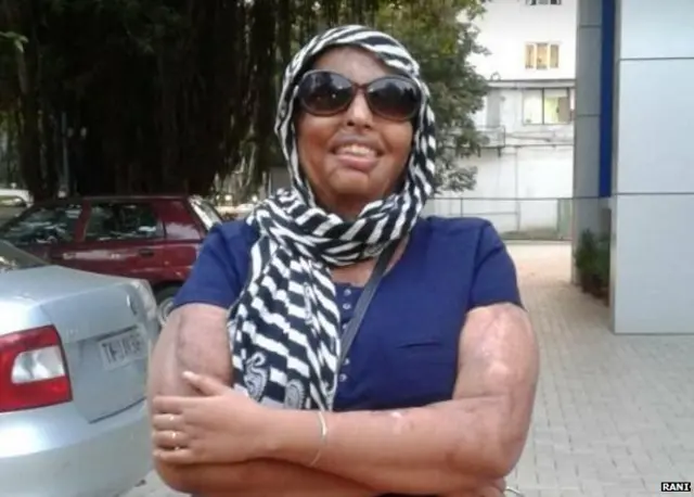 तेज़ाबी हमला