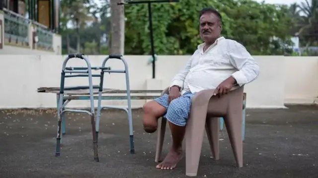 Mguu wa Devendra ulilazimika kukatwa baada ya kuumwa na nyoka alipokuwa akichuma majani ya mkuyu