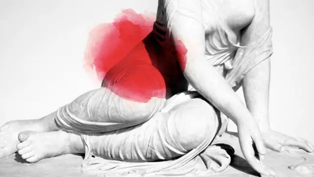 Ендометріоз