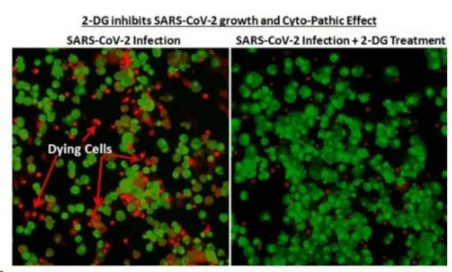 డీఆర్‌డీఓ