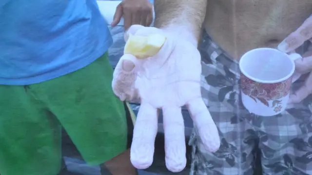 Рука Арчибальда