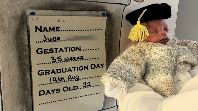 Jude sale de la unidad neonatal. Lleva un gorro de lana con forma de gorra de graduación y un cárdigan grande y grueso de color blanco, gris y crema. Tiene un tubo que le sale por la nariz y solo un ojo abierto. Lo sostienen junto a un tablero que detalla su nombre, gestación, día de graduación y días de vida.