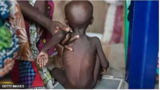 Ọmọde ti ebi ṣọṣẹ fun