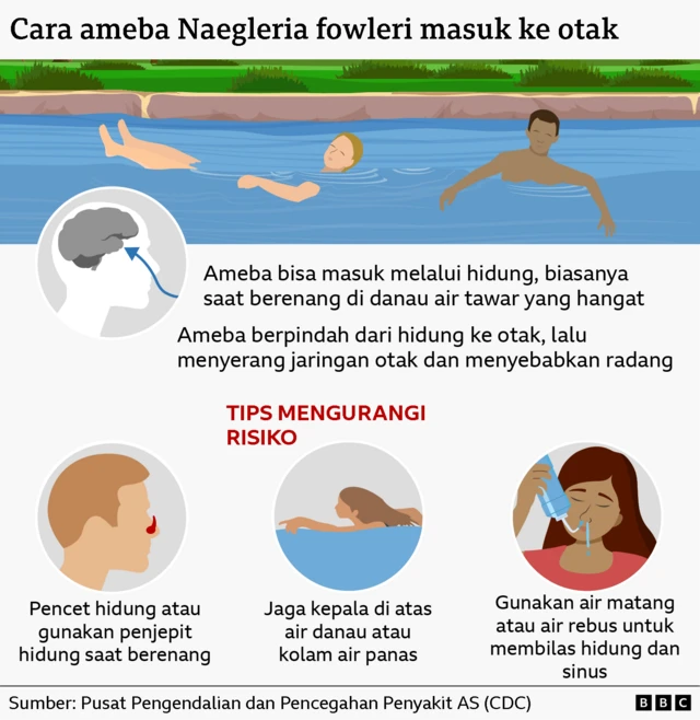 Cara ameba masuk otak