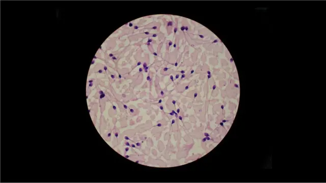 L'homme moyen libère environ 100 millions de spermatozoïdes au cours d'une seule éjaculation.
