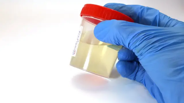 Determinar que una droga que mejora el rendimiento de los deportistas es un potencial elemento de dopaje podría demorar años.