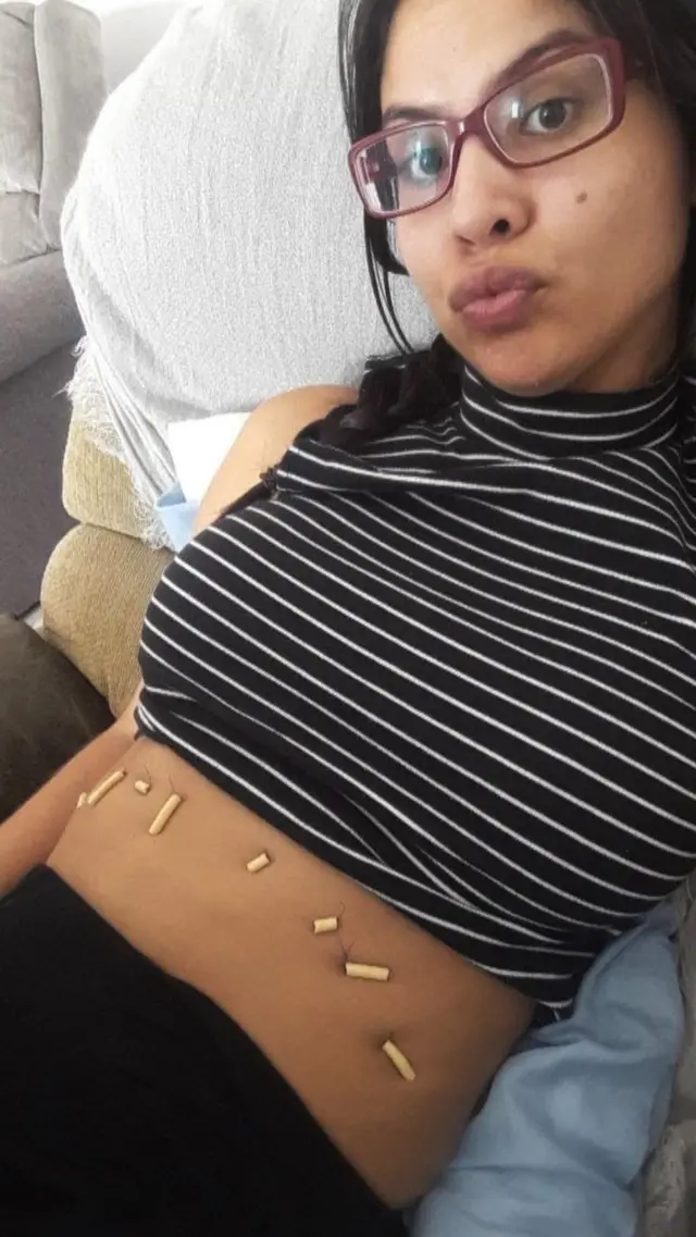 Carem, recovering from organ transplant surgery