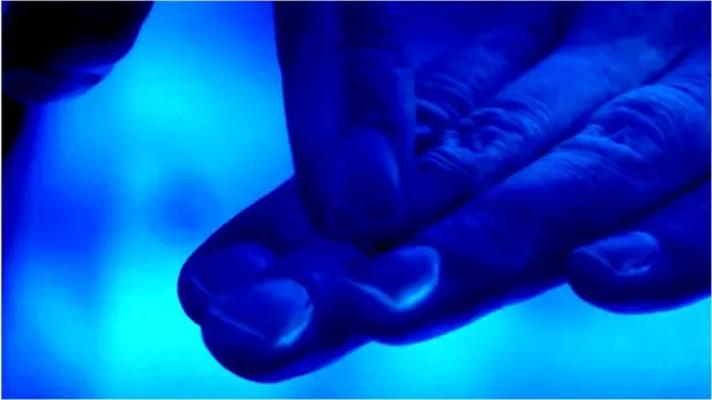 గోళ్లపై క్రిములు