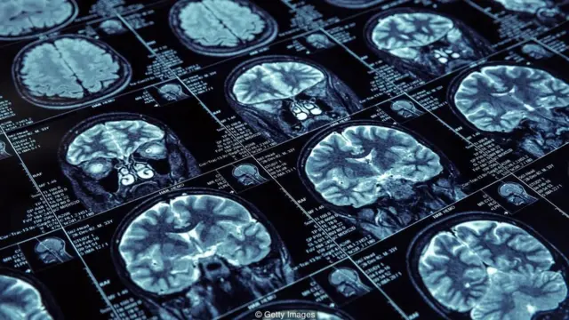 otak, slow-wave sleep