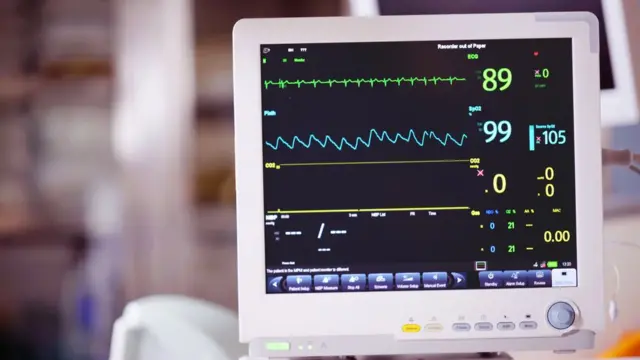 Tela com eletrocardiograma