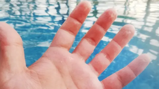 Una mano con dedos arrugados