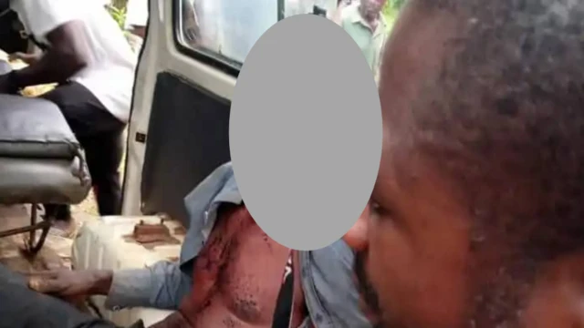 Onye emerụrụ ahụ