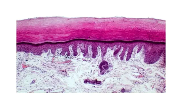 Alors que les rayons UVB ont tendance à endommager la surface de la peau, les rayons UVA sont beaucoup plus profonds et peuvent tous deux provoquer une inflammation systémique.