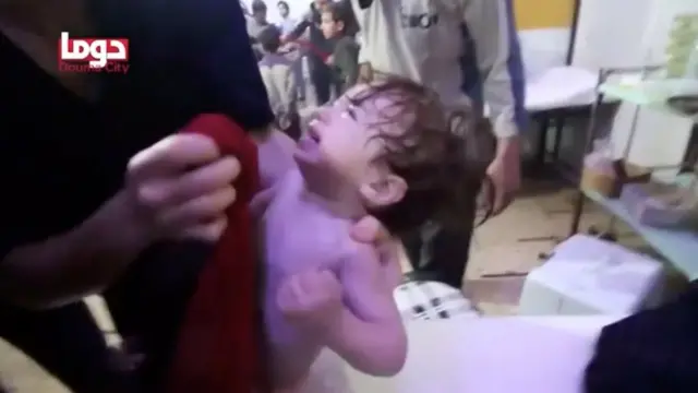 Imagen suministrada por los cascos blancos muestra un menor afectado por el supuesto ataque químico en Duma, este de Damasco