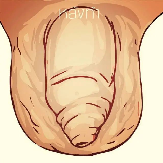 ภาพประกอบ