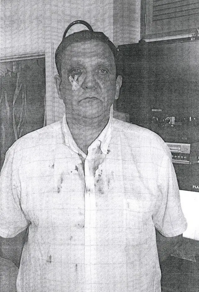 Терлюк после нападения