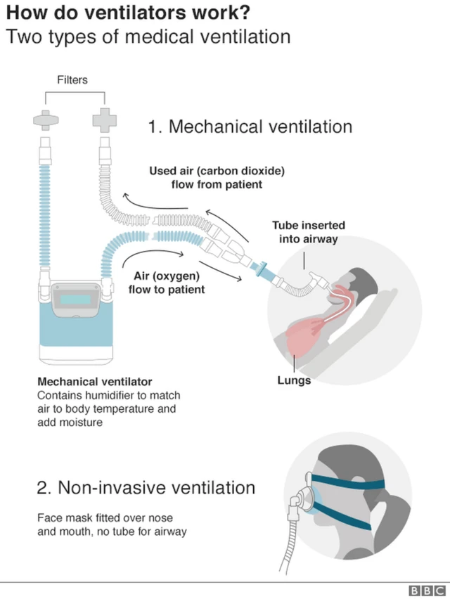 Graphic showing two common types of medical ventilation