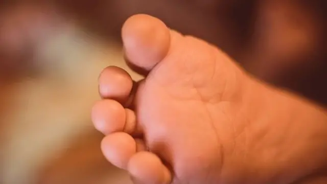 மூளைச் சாவு அடைந்து மூன்று மாதமான பெண்ணுக்கு பிறந்த குழந்தை