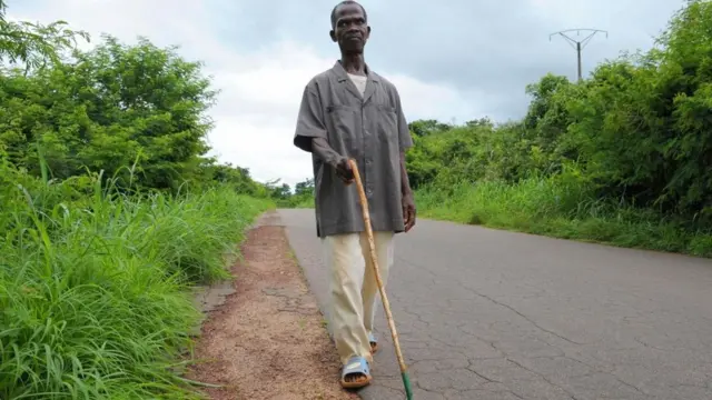 لغز مرض "الموت الأصغر" الغامض في شرق أفريقيا