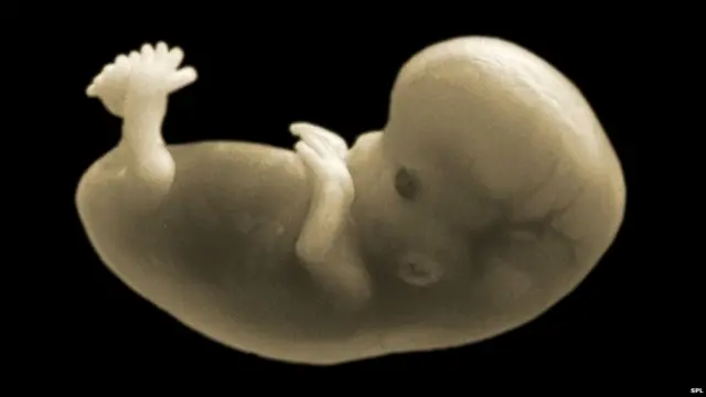 ਭਰੂਣ ਦੇ ਜਿਉਣ ਦਾ ਅਧਿਕਾਰ