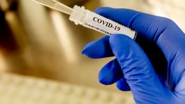 KORONAVİRUS VAKSİN aZƏRBAYCAN 65 yaşüstü