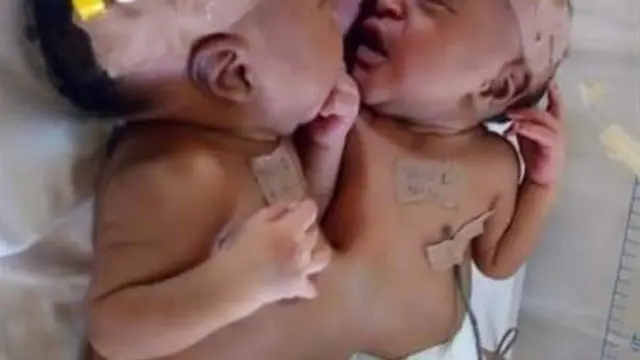 Ejima gbakọrọ ọnu