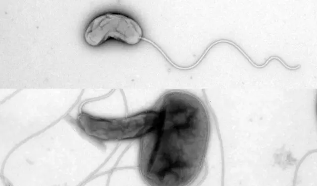 Bdellovibrio sólo y atacando a una bacteria
