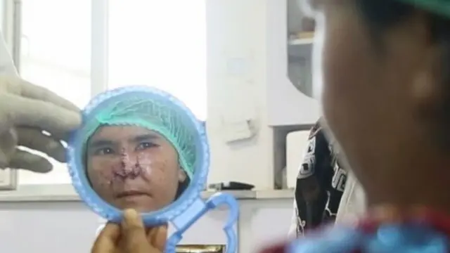 زرقا میگوید از نتیجه جراحی بازسازی صورتش راضی است