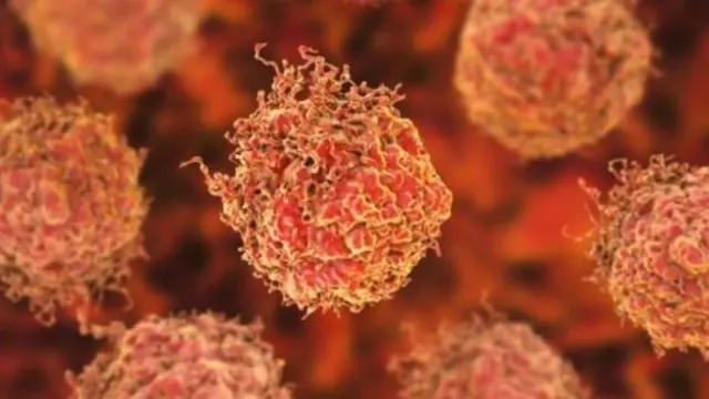 prostate cancer blood test