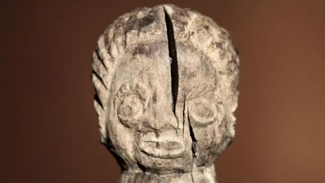 मायग्रेन 