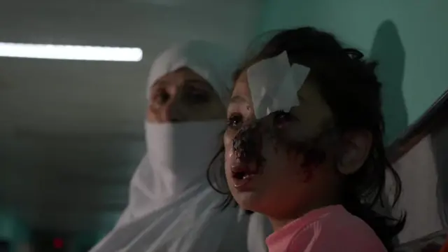 病院の廊下で額にばんそうこうを貼った少女が、カメラ外の記者を見上げている。顔には血がこびりついている。背後には白いスカーフを頭部にかぶった女性がついている