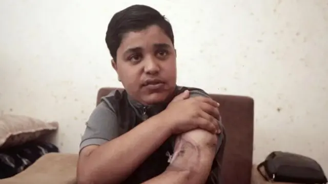 અબ્દુલ્લા પોતાના હાથમાં થયેલી ઈજા દેખાડી રહ્યો છે