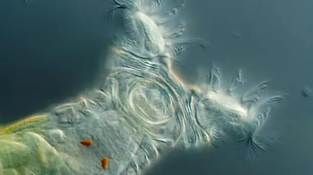 A magnified image of a semi-translucent microorganism showing a V-shaped head and the top of its greenish body.