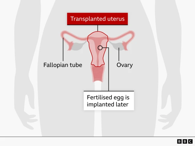 Anatomical illustration of a female reproductive system