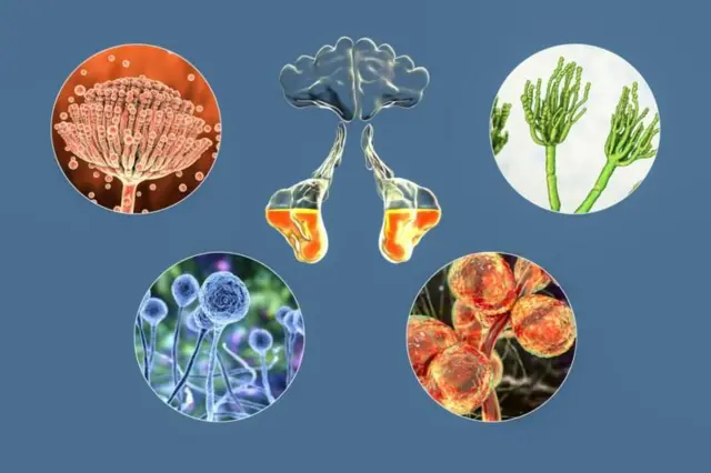 બીબીસી ગુજરાતી, ગુજરાત, બીબીસી, અમદાવાદ, સાઇનસ, શરદી, હેલ્થ, સ્વાસ્થ્ય