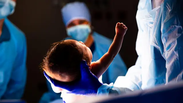 Bebé naciendo por cesárea