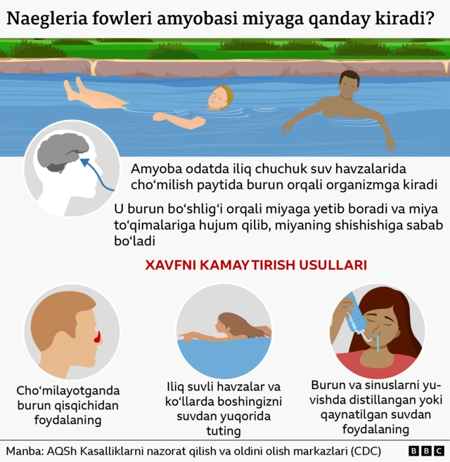 Инфографика: Naegleria fowleri амёбаси мияга қандай қилиб етиб боради?