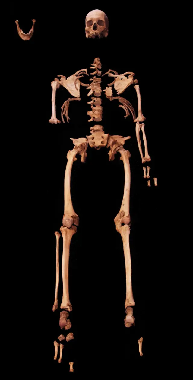 Esqueleto quase completo, faltando o antebraço direito, assim como os dedos das mãos e dos pés em cada mão e pé, contra um fundo preto